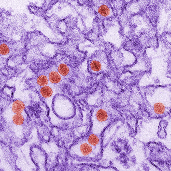 Вирусы — незримые убийцы